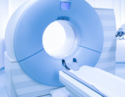 Screenende total-body MRI-scans: de toekomst of onnodige zorgkosten?