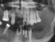 Niet-tandheelkundige toepassingen van cone-beam CT