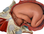 Beeldvorming van de uterus bij het placenta accreta spectrum